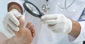 Doctor examines legs affected by fungi